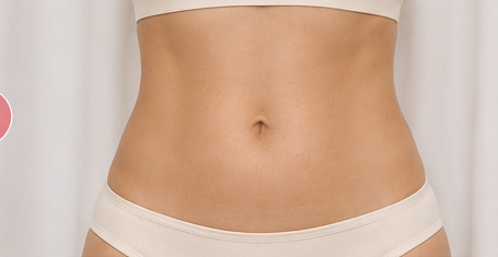 Nachher: Bauch und Taille