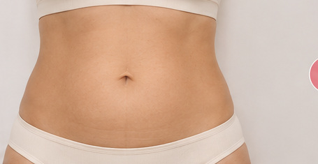 Vorher: Bauch und Taille